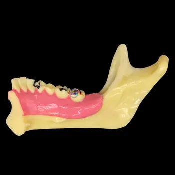 Zobu Mandibular Zobu Demonstrēšanas Anatomijas Pacientu Studiju Mācību Modelis